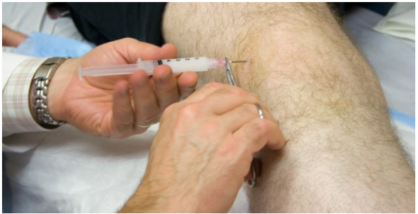 קובץ:Intra-articular injection1.png