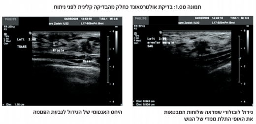 Ultrasound1.png