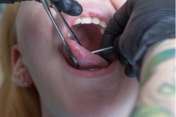 Oral piercing .jpg