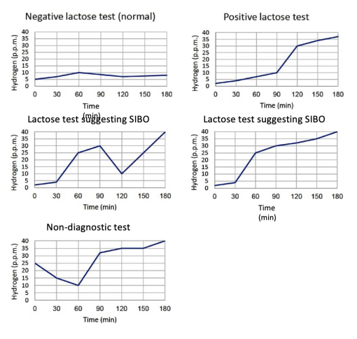 דוגמאות לפענוח מספר תבחיני נשיפה לאי סבילות ללקטוז.png