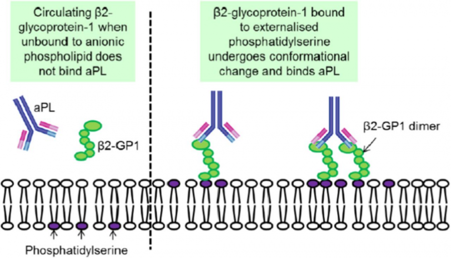 נוגדנים מסוג IgG או IgM ל-Beta 2 glycoprotein 1 – ויקירפואה