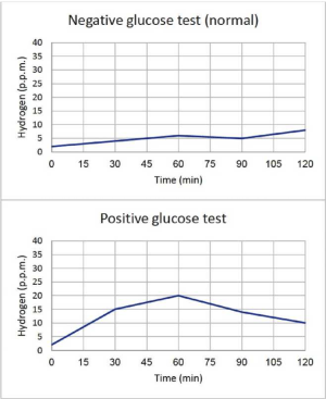דוגמאות לפענוח תבחיני נשיפה ל- SIBO מבוססי גלוקוז.png